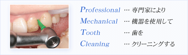 PMTCとは、専門家により、器機を使用して、歯を、クリーニングする
